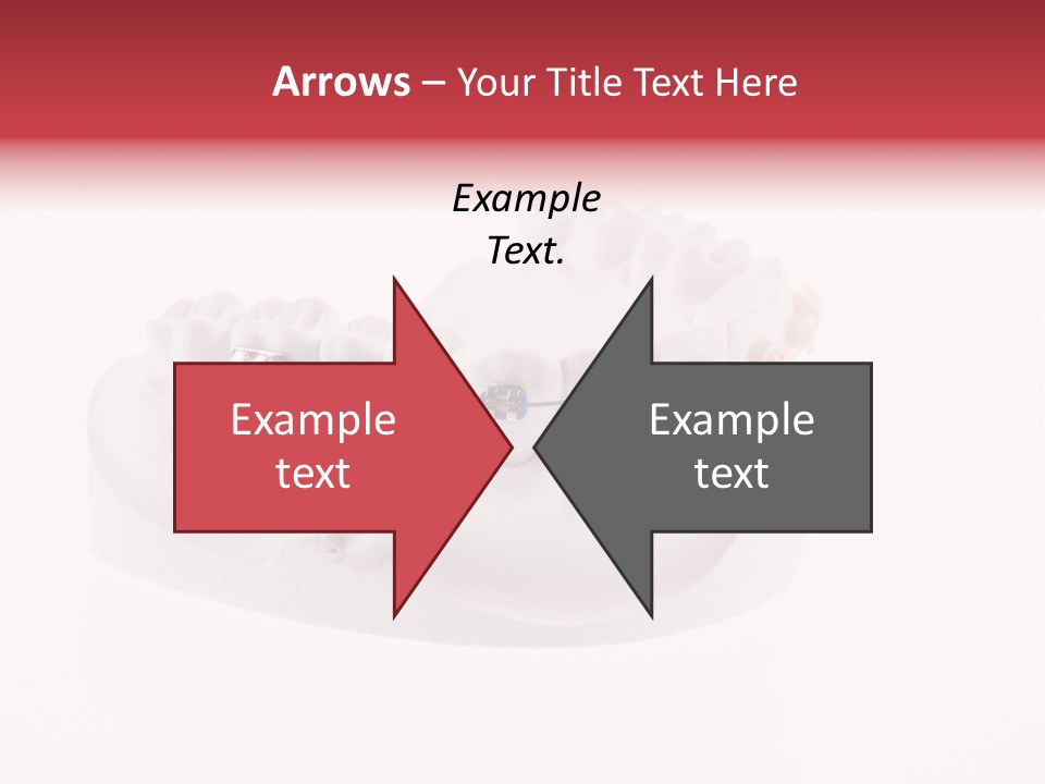 Medical Teeth Treatment PowerPoint Template