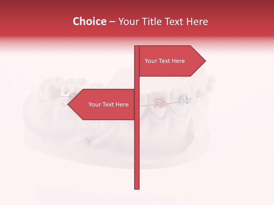 Medical Teeth Treatment PowerPoint Template