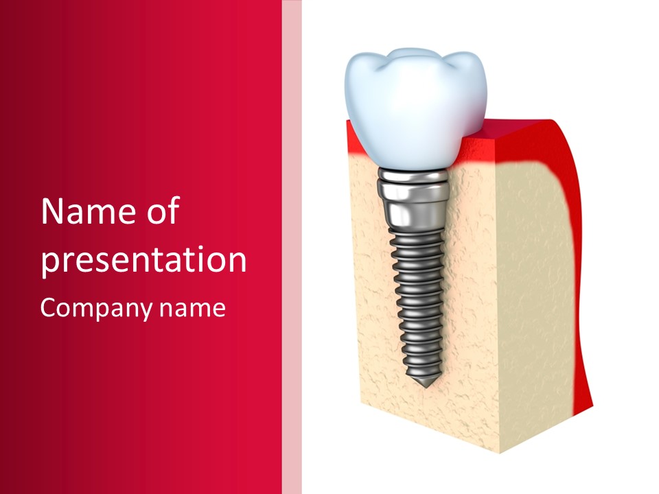 Prosthesis Bone Care PowerPoint Template