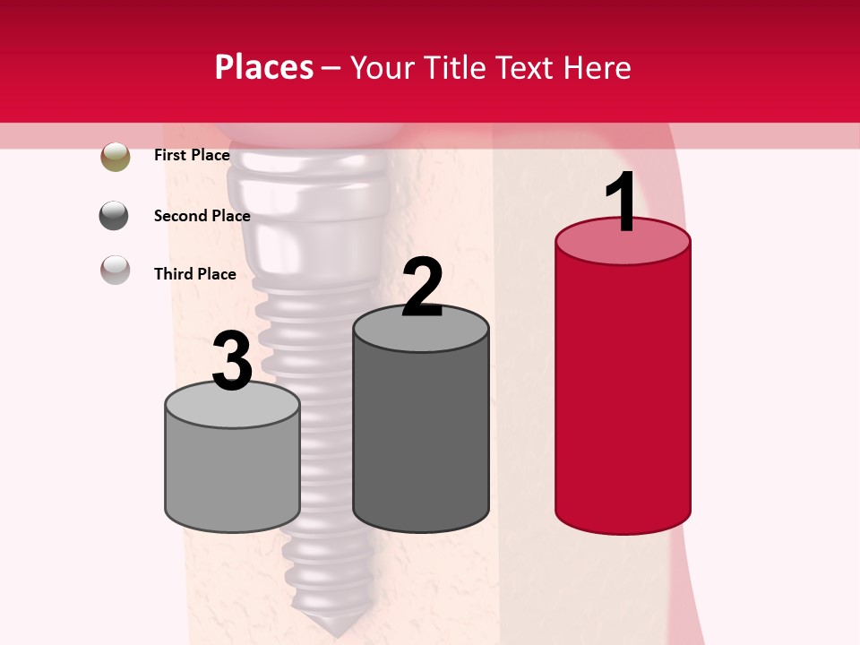 Prosthesis Bone Care PowerPoint Template