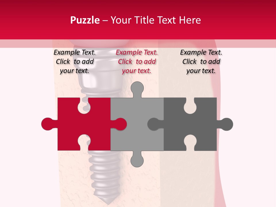 Prosthesis Bone Care PowerPoint Template