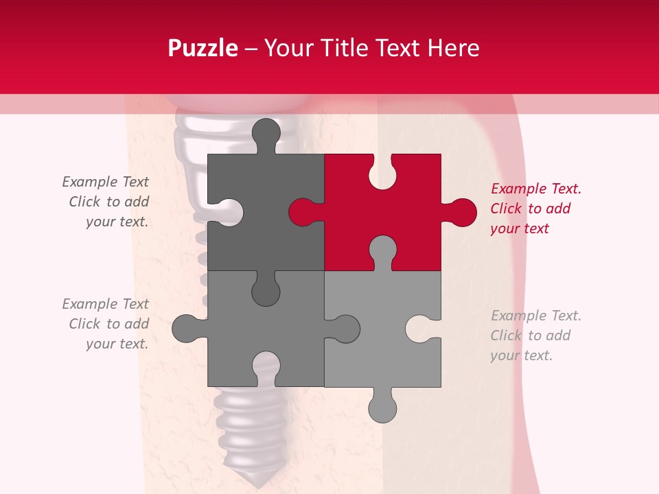 Prosthesis Bone Care PowerPoint Template