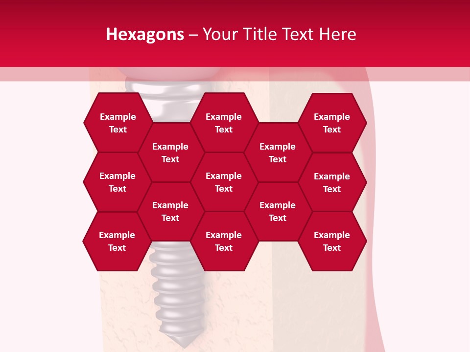 Prosthesis Bone Care PowerPoint Template
