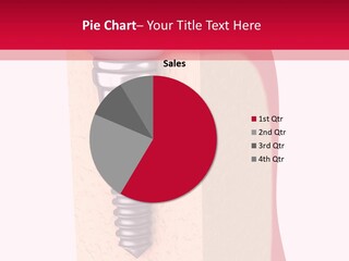 Prosthesis Bone Care PowerPoint Template