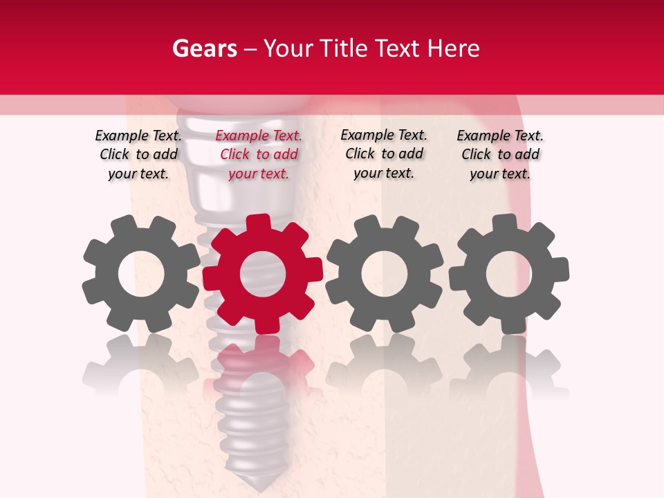 Prosthesis Bone Care PowerPoint Template