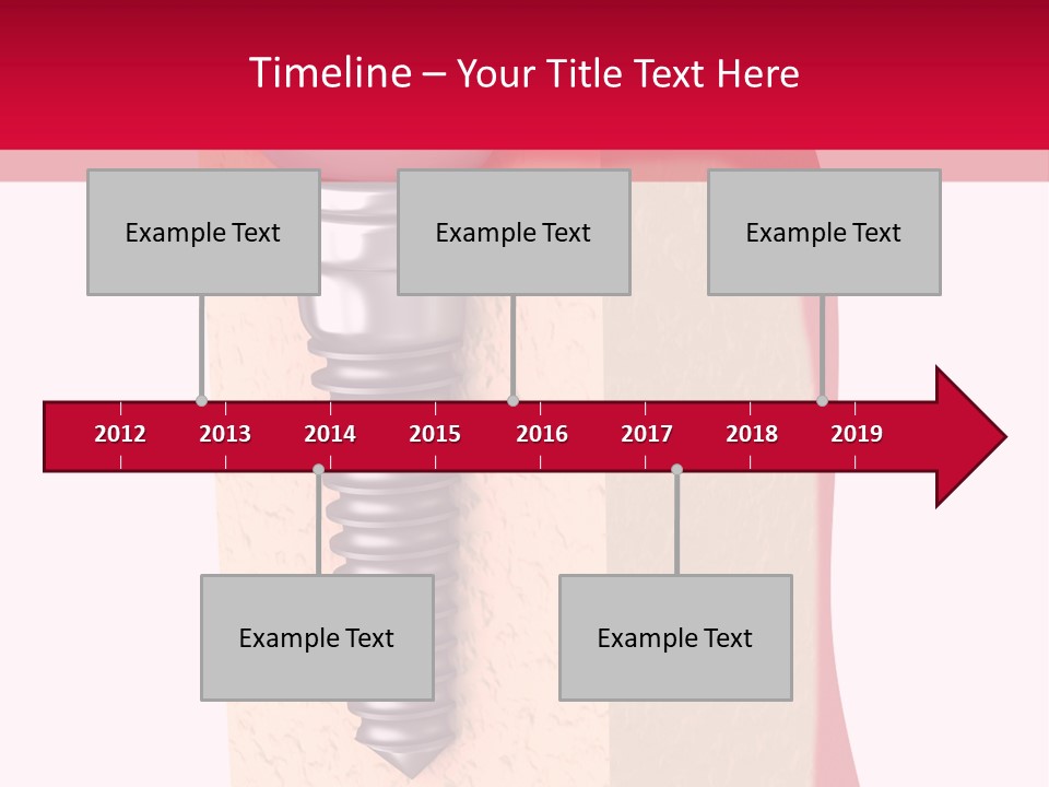 Prosthesis Bone Care PowerPoint Template