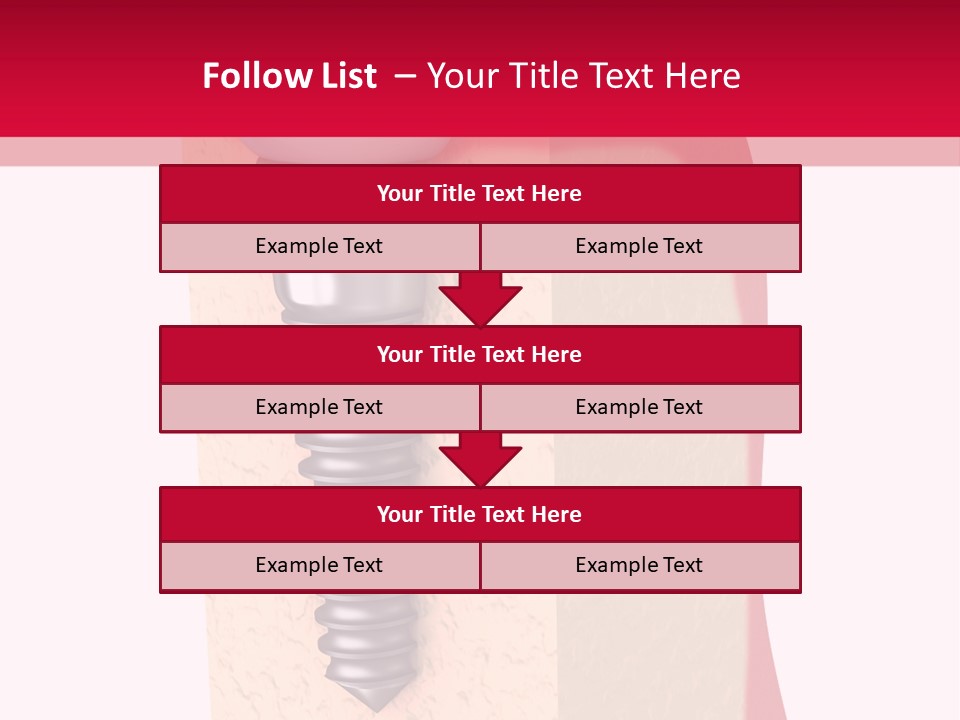 Prosthesis Bone Care PowerPoint Template