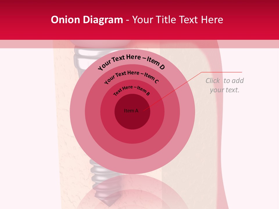 Prosthesis Bone Care PowerPoint Template