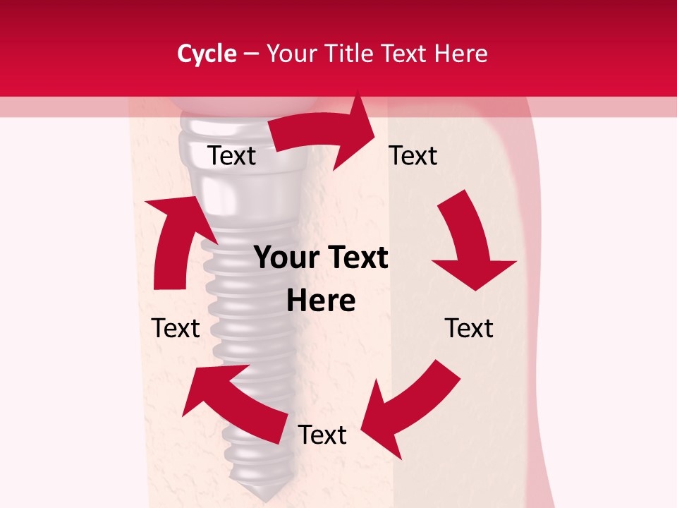 Prosthesis Bone Care PowerPoint Template