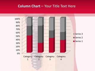 Prosthesis Bone Care PowerPoint Template