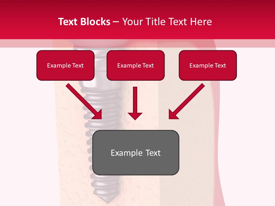 Prosthesis Bone Care PowerPoint Template