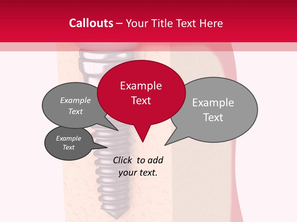 Prosthesis Bone Care PowerPoint Template