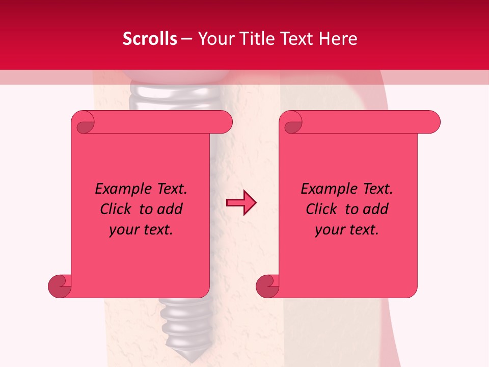Prosthesis Bone Care PowerPoint Template