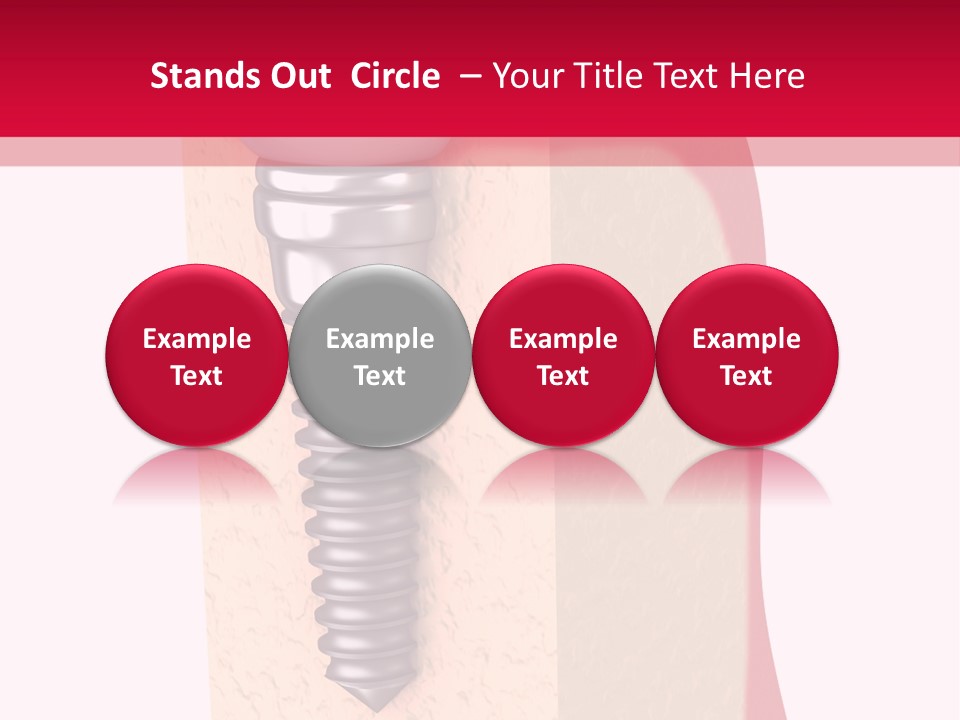 Prosthesis Bone Care PowerPoint Template
