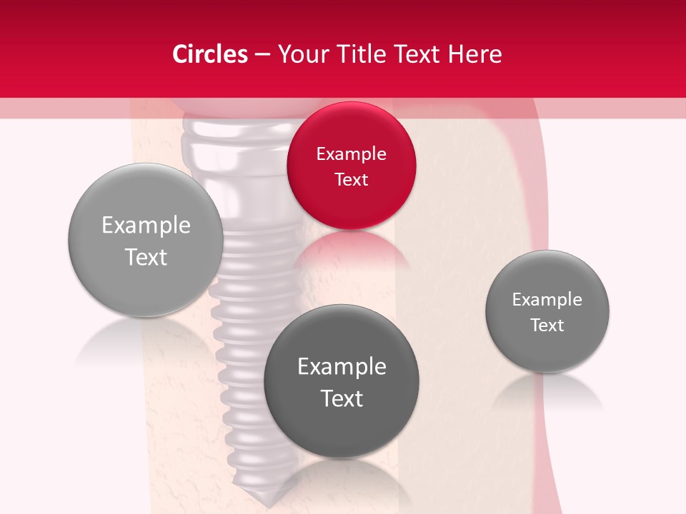 Prosthesis Bone Care PowerPoint Template