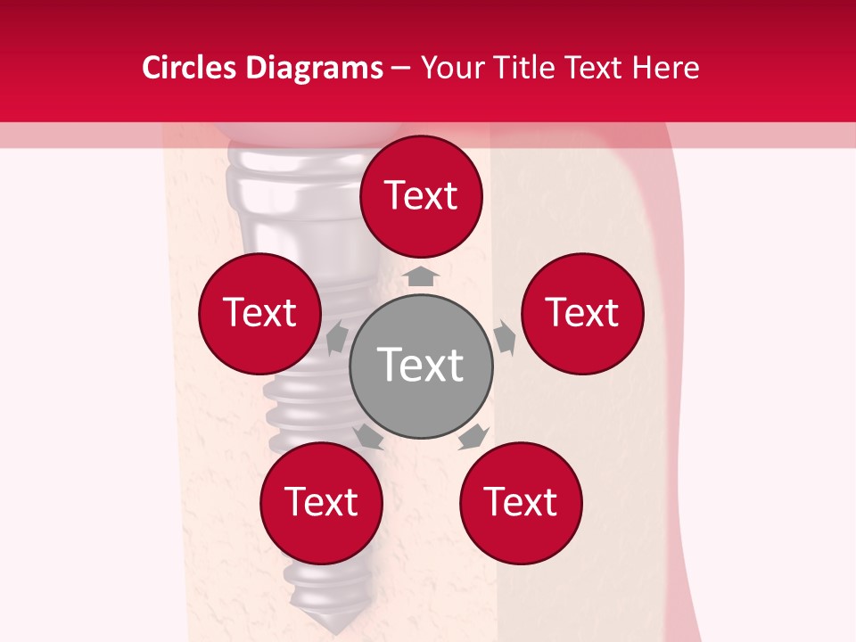 Prosthesis Bone Care PowerPoint Template