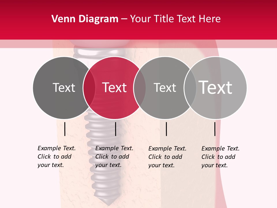 Prosthesis Bone Care PowerPoint Template
