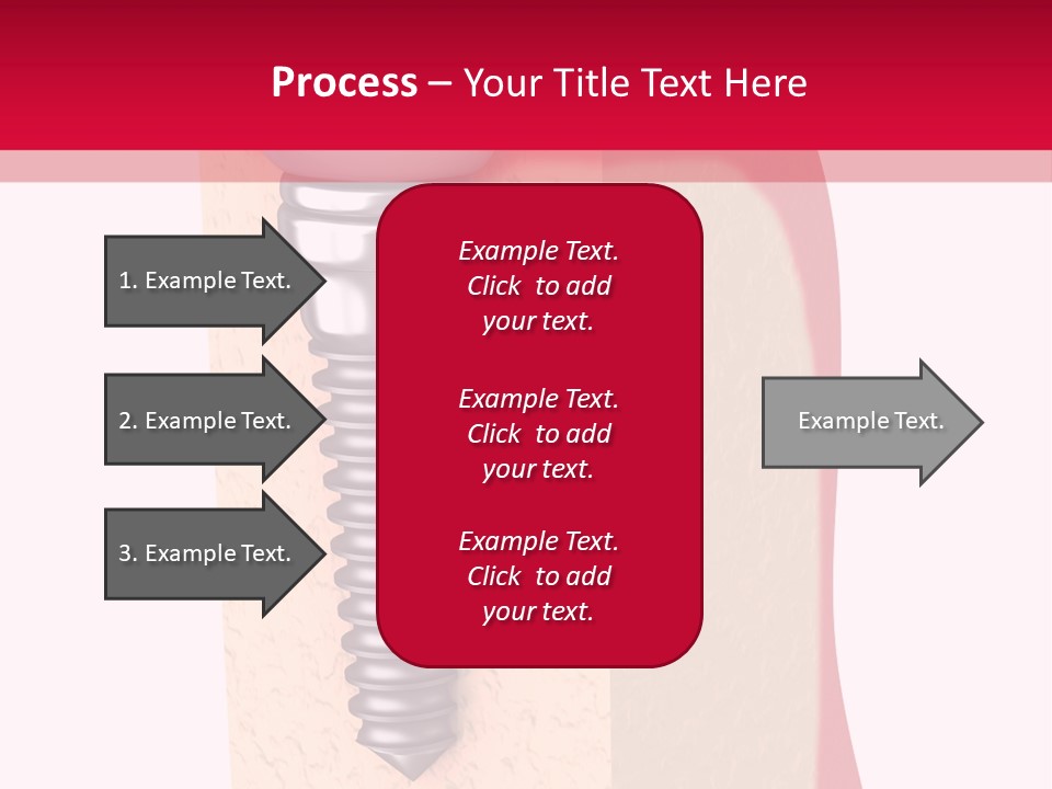 Prosthesis Bone Care PowerPoint Template