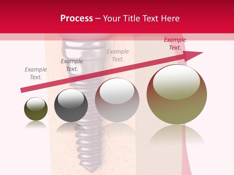 Prosthesis Bone Care PowerPoint Template