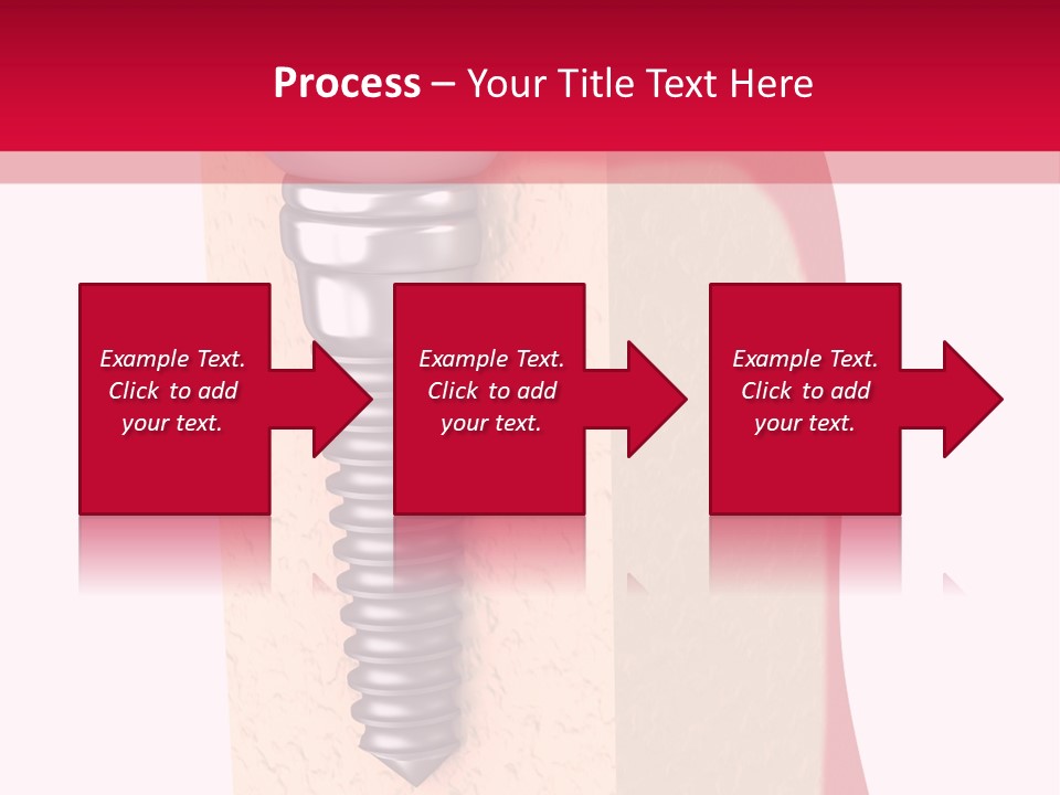 Prosthesis Bone Care PowerPoint Template
