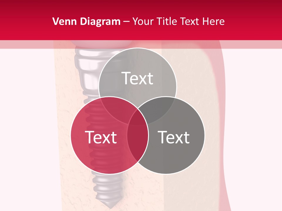 Prosthesis Bone Care PowerPoint Template