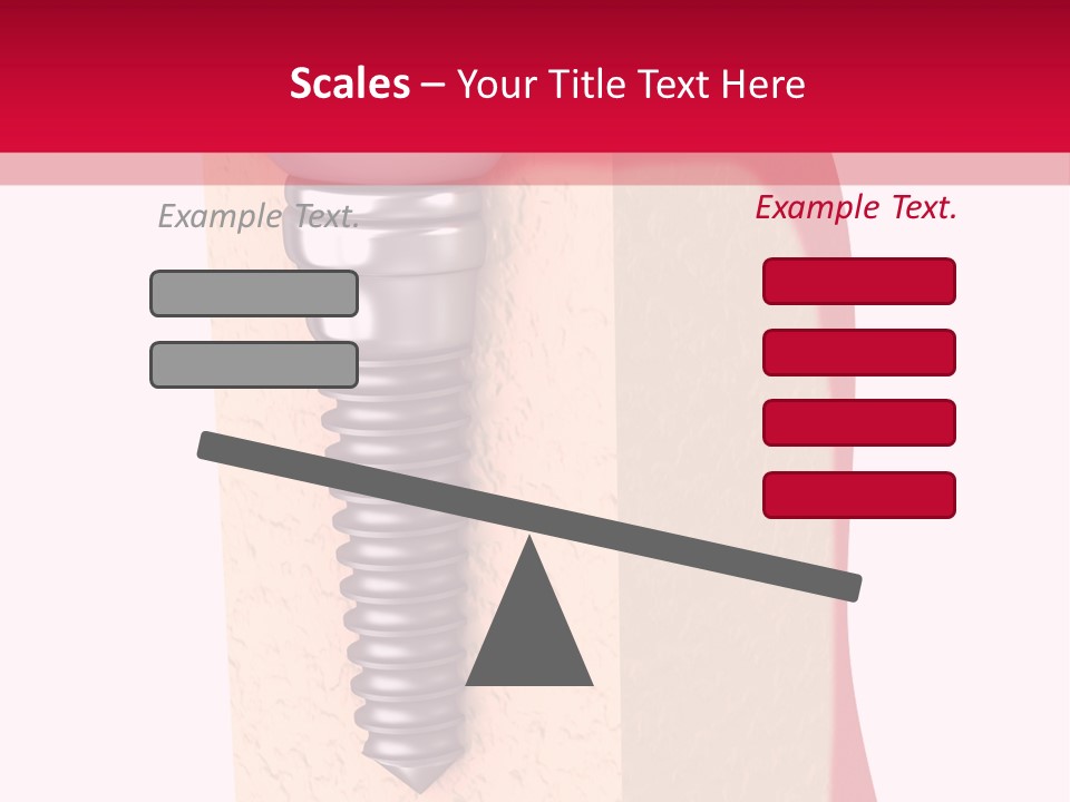 Prosthesis Bone Care PowerPoint Template