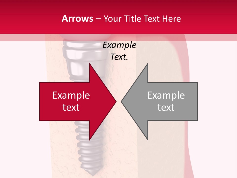 Prosthesis Bone Care PowerPoint Template