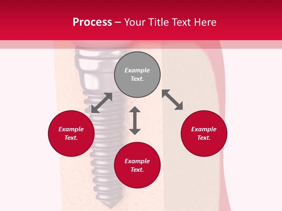 Prosthesis Bone Care PowerPoint Template