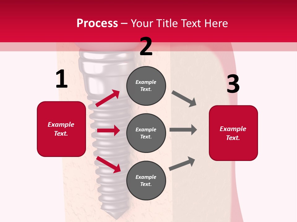 Prosthesis Bone Care PowerPoint Template