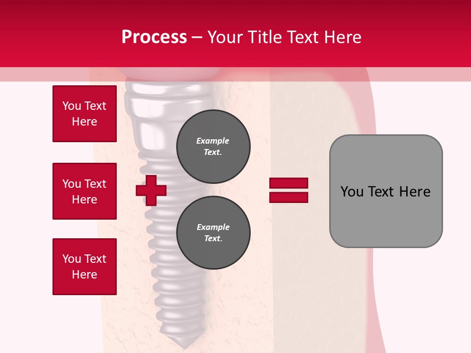 Prosthesis Bone Care PowerPoint Template