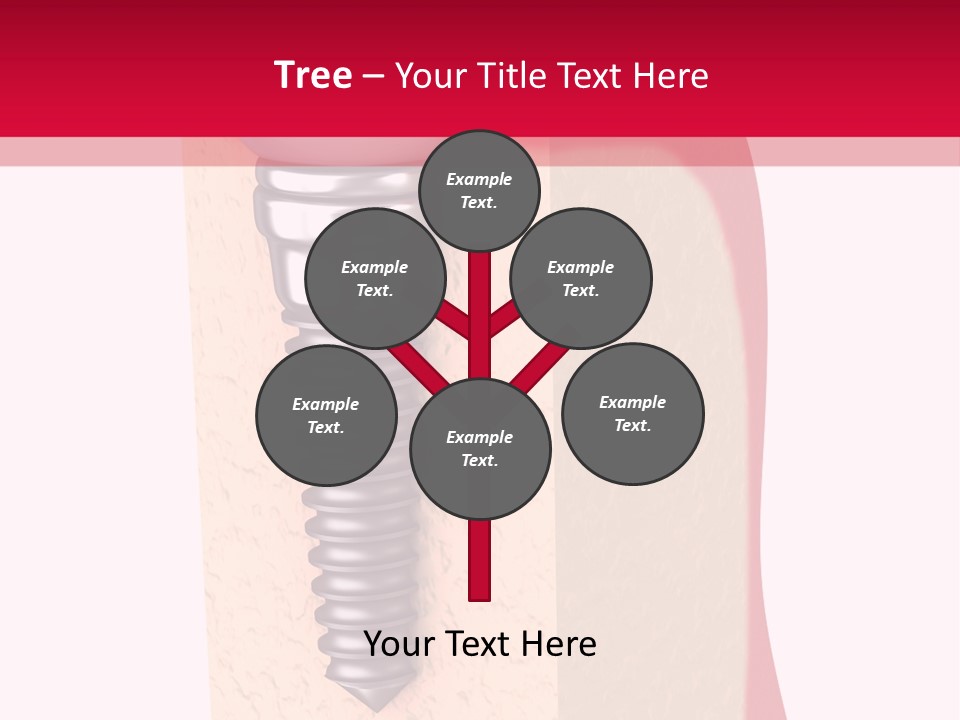 Prosthesis Bone Care PowerPoint Template