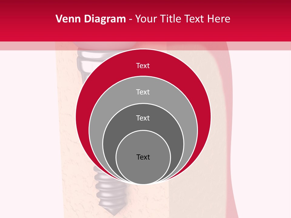 Prosthesis Bone Care PowerPoint Template