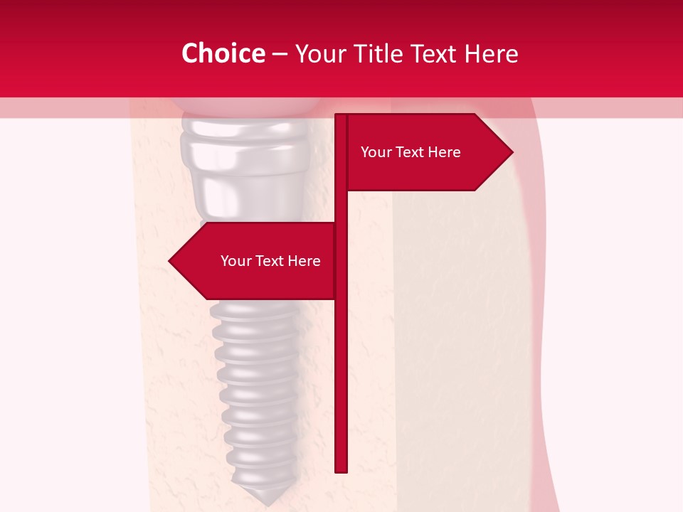 Prosthesis Bone Care PowerPoint Template