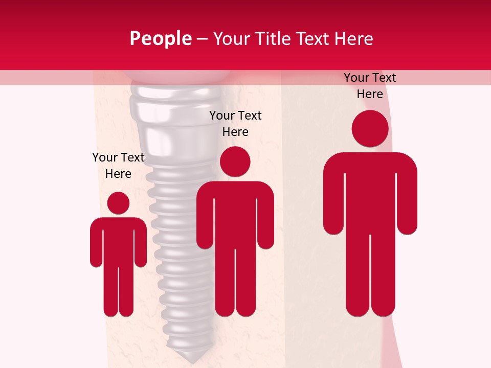 Prosthesis Bone Care PowerPoint Template