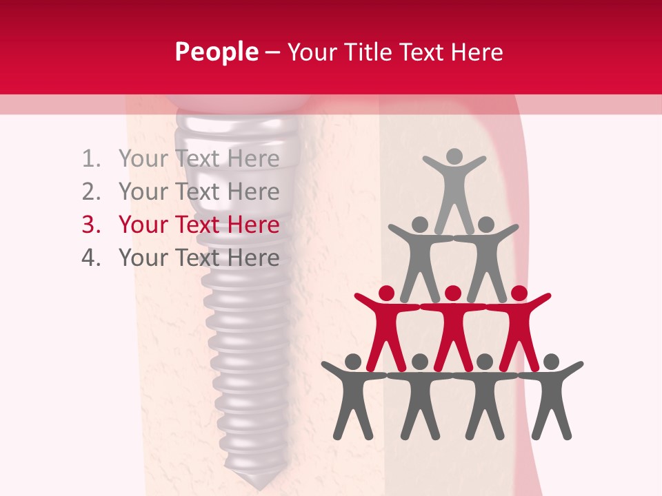 Prosthesis Bone Care PowerPoint Template