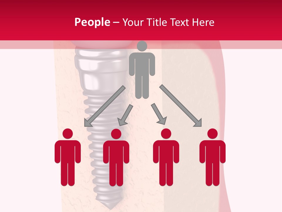 Prosthesis Bone Care PowerPoint Template