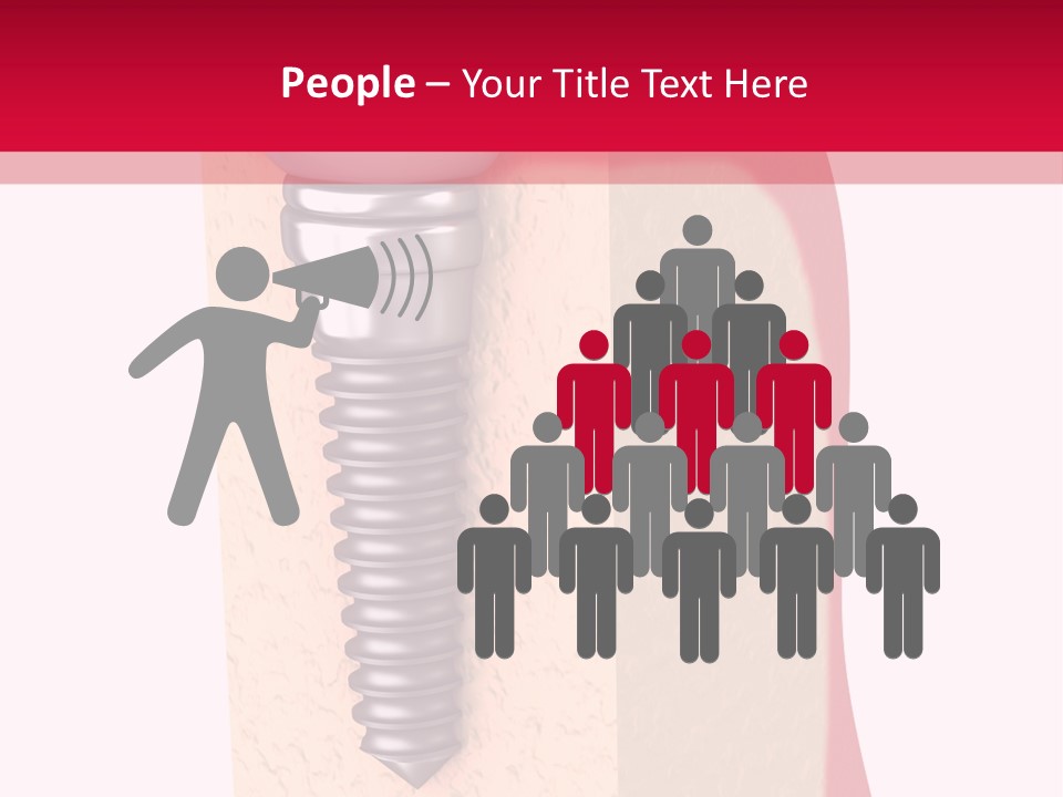 Prosthesis Bone Care PowerPoint Template