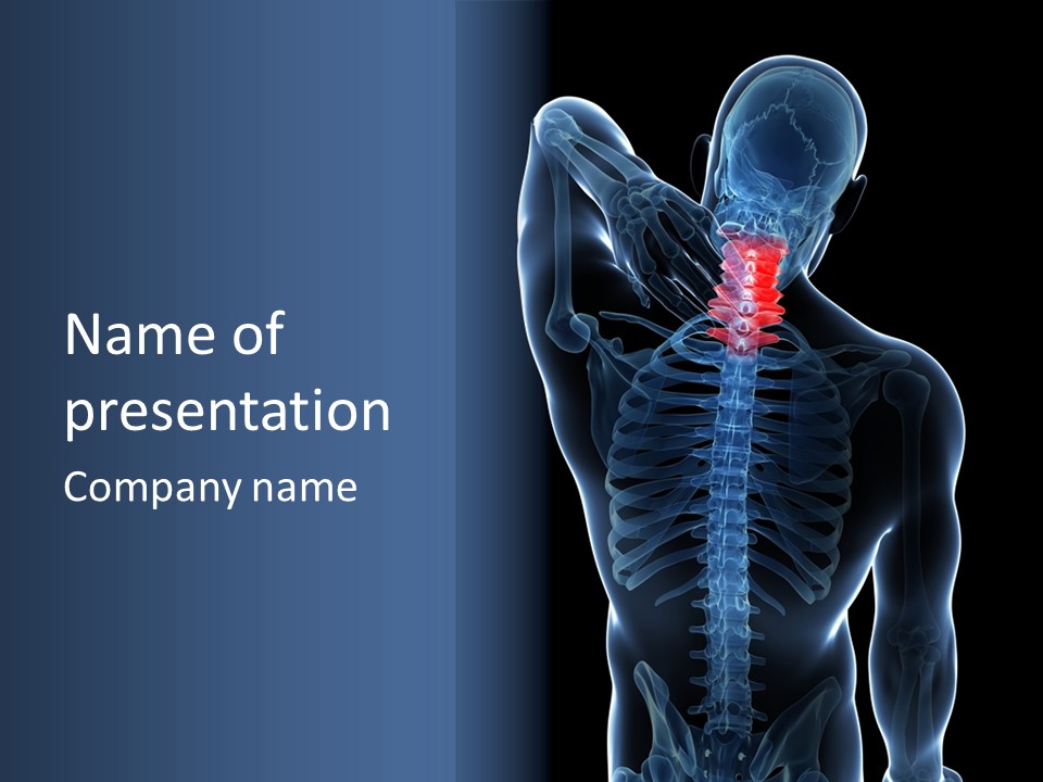 Examination Vertebra Backbone PowerPoint Template