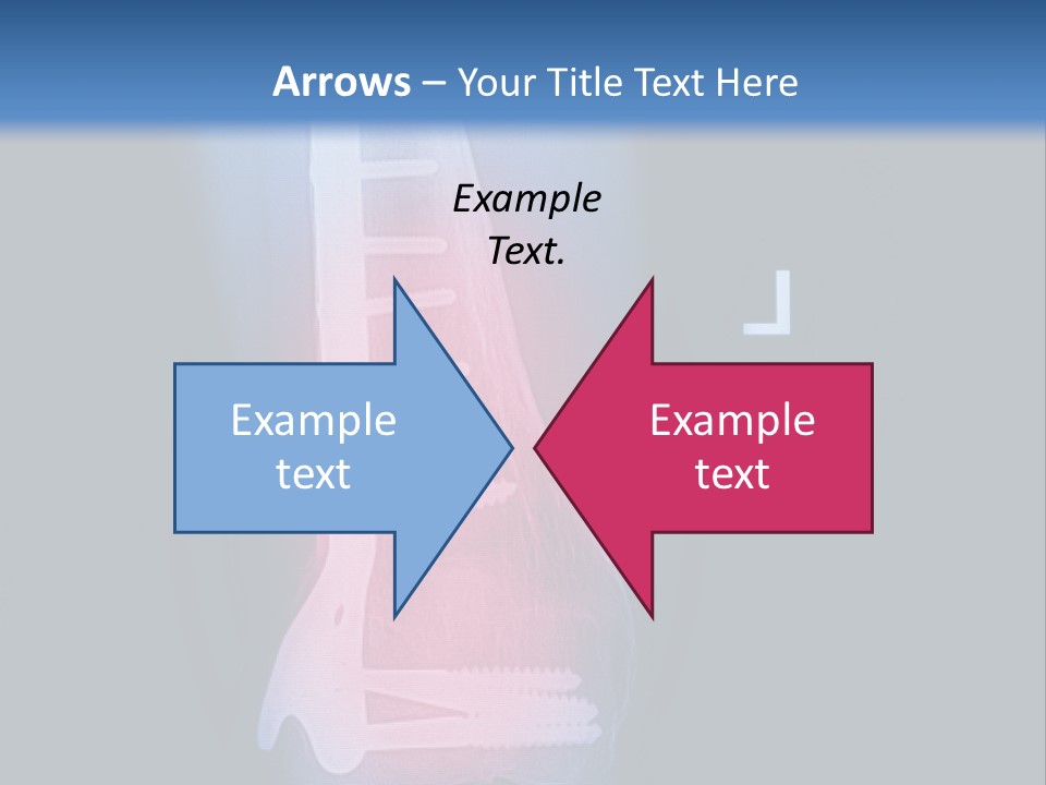 Symptom Body Part Metallic PowerPoint Template