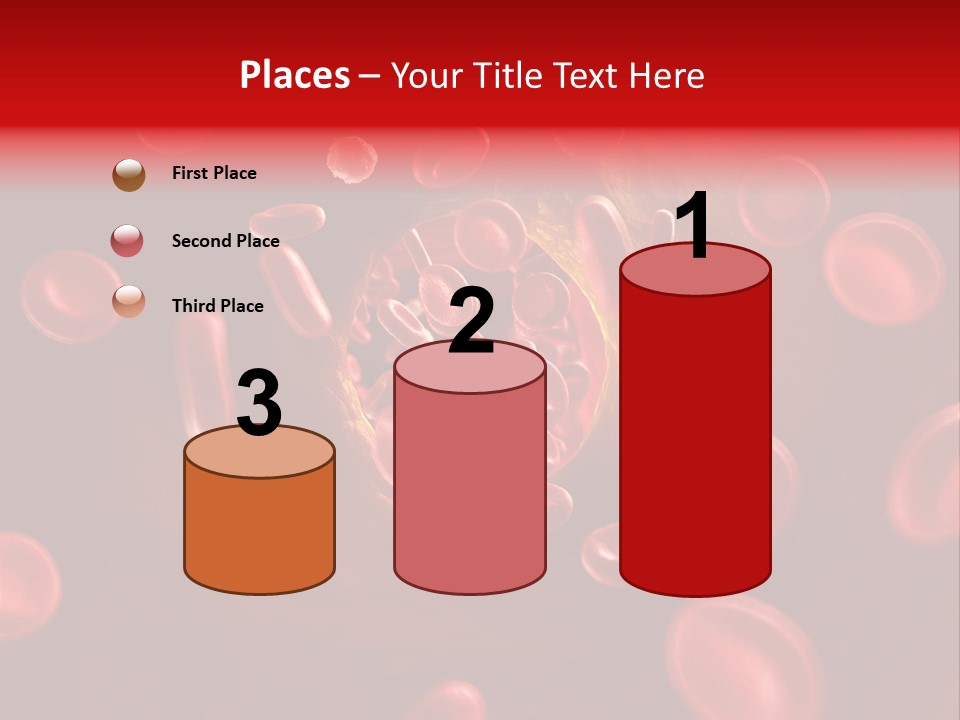 Illustration Of Arteriosklerosis PowerPoint Template
