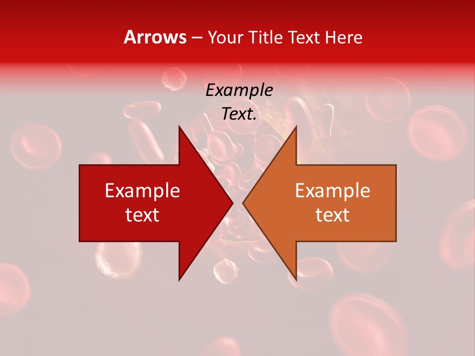 Illustration Of Arteriosklerosis PowerPoint Template