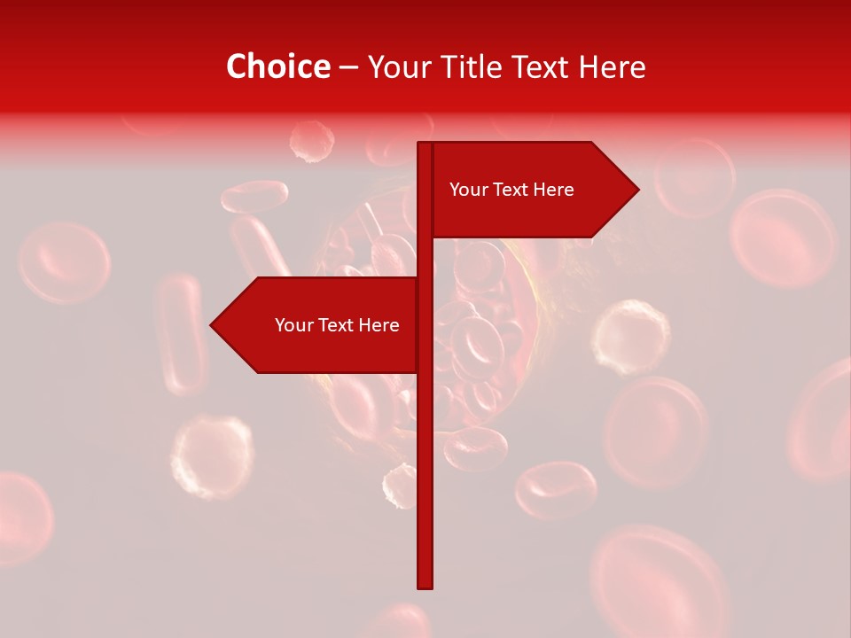 Illustration Of Arteriosklerosis PowerPoint Template