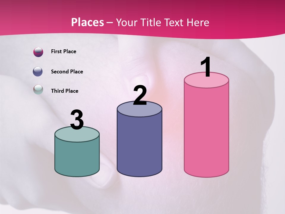 Sportler Verletzung Meniscus PowerPoint Template