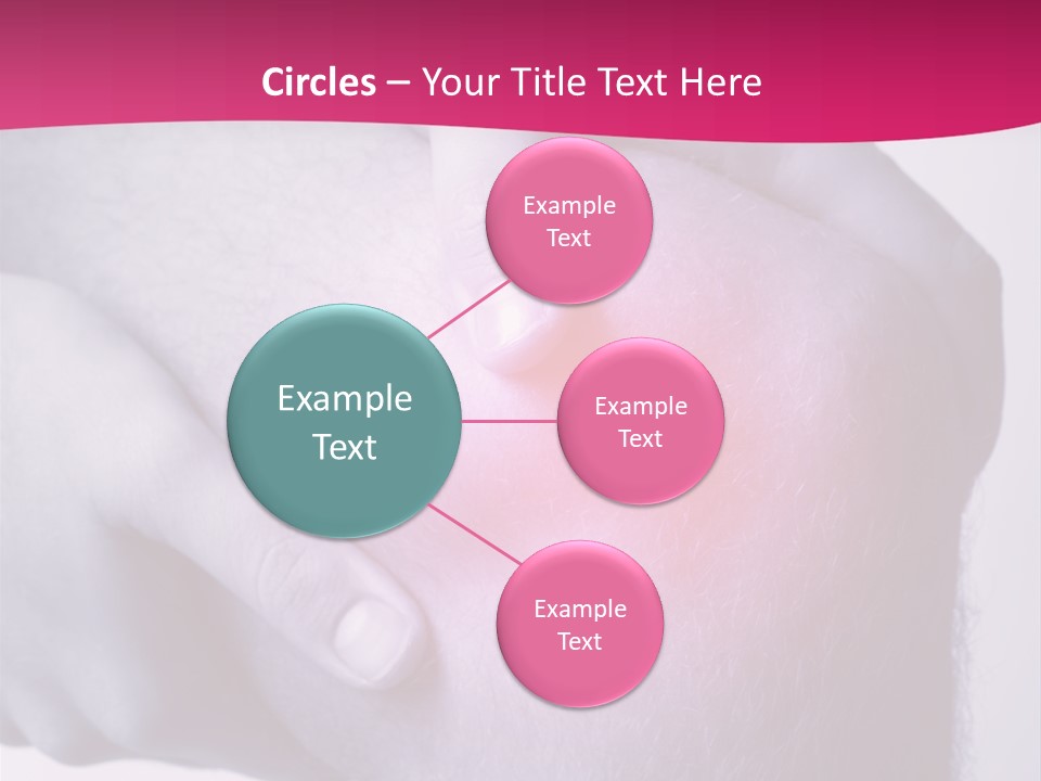 Sportler Verletzung Meniscus PowerPoint Template