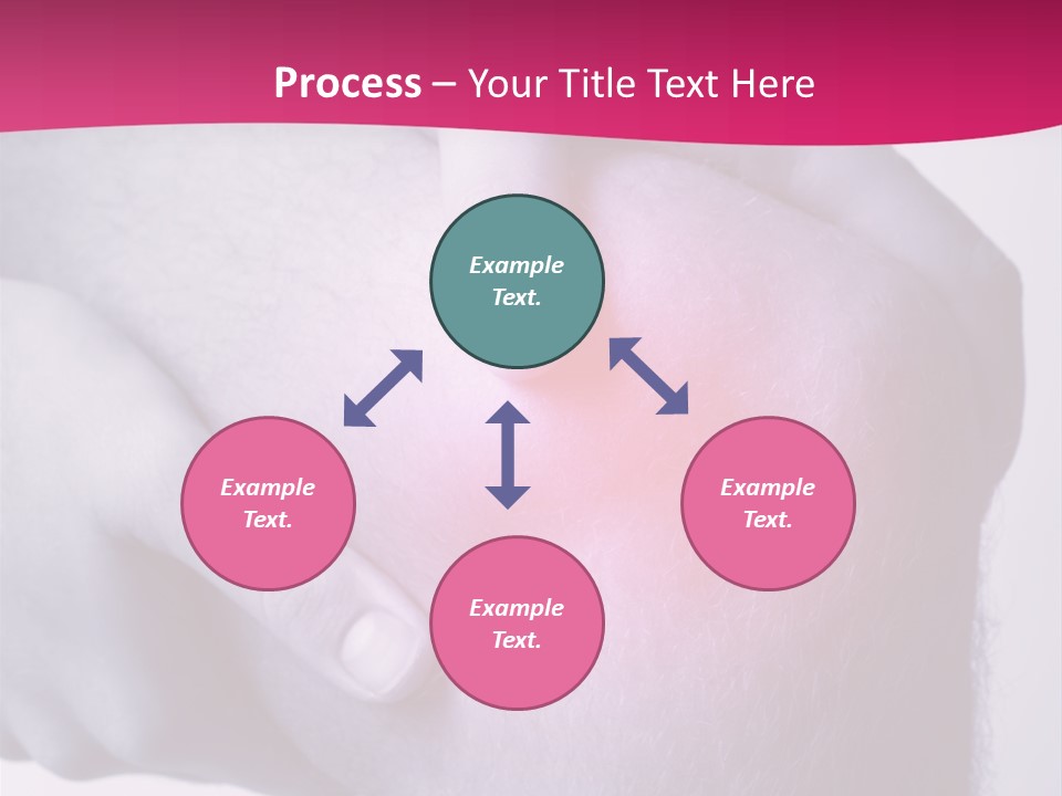 Sportler Verletzung Meniscus PowerPoint Template