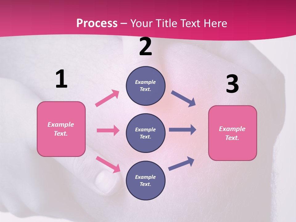 Sportler Verletzung Meniscus PowerPoint Template