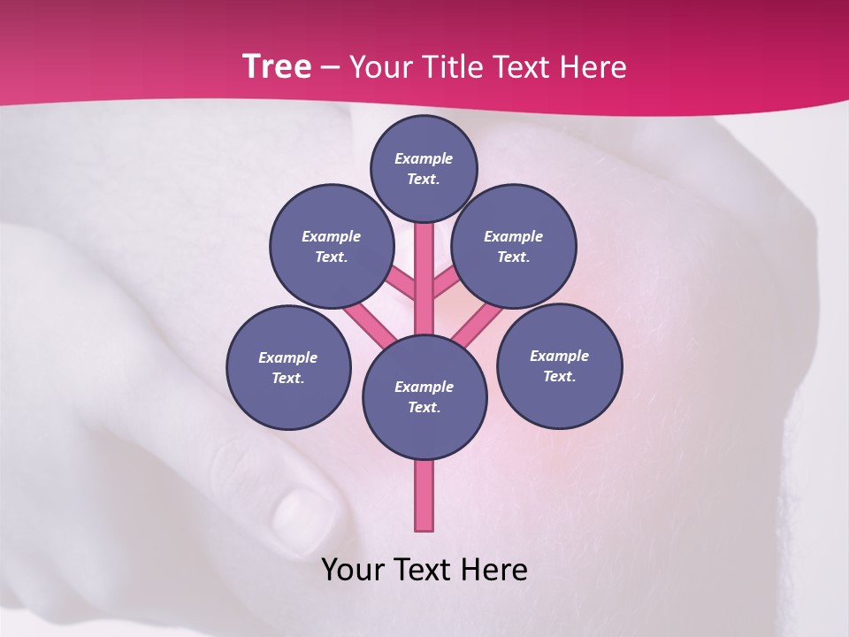 Sportler Verletzung Meniscus PowerPoint Template