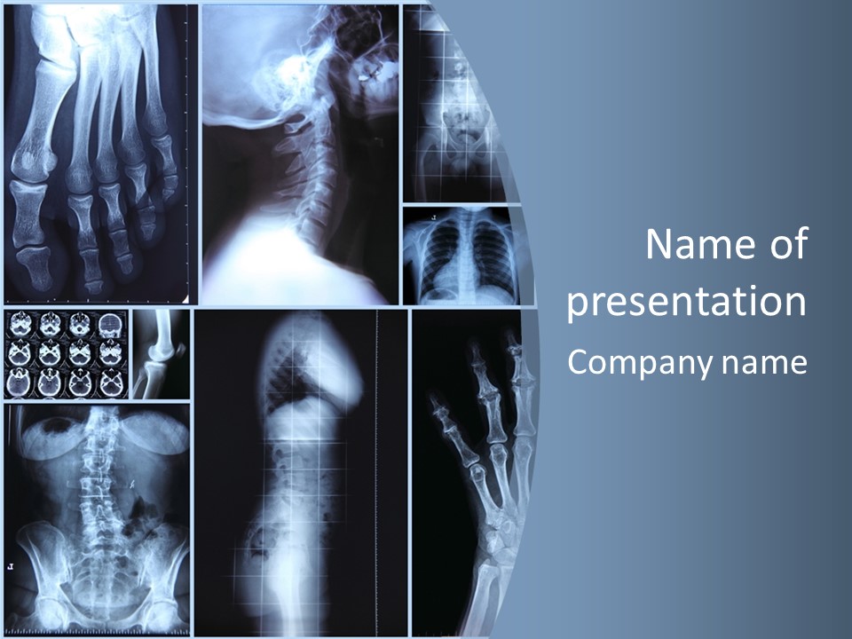 Radiation Shin Bones PowerPoint Template