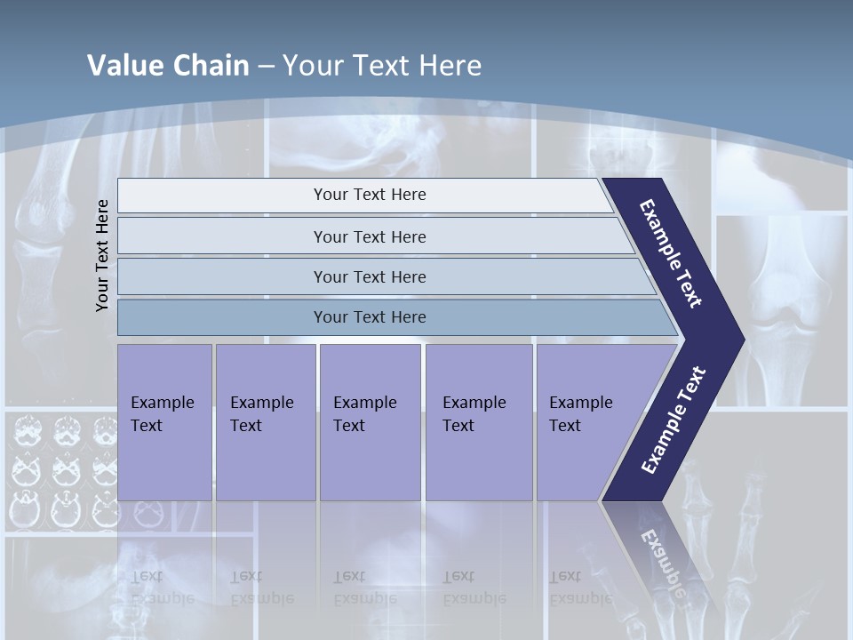 Radiation Shin Bones PowerPoint Template