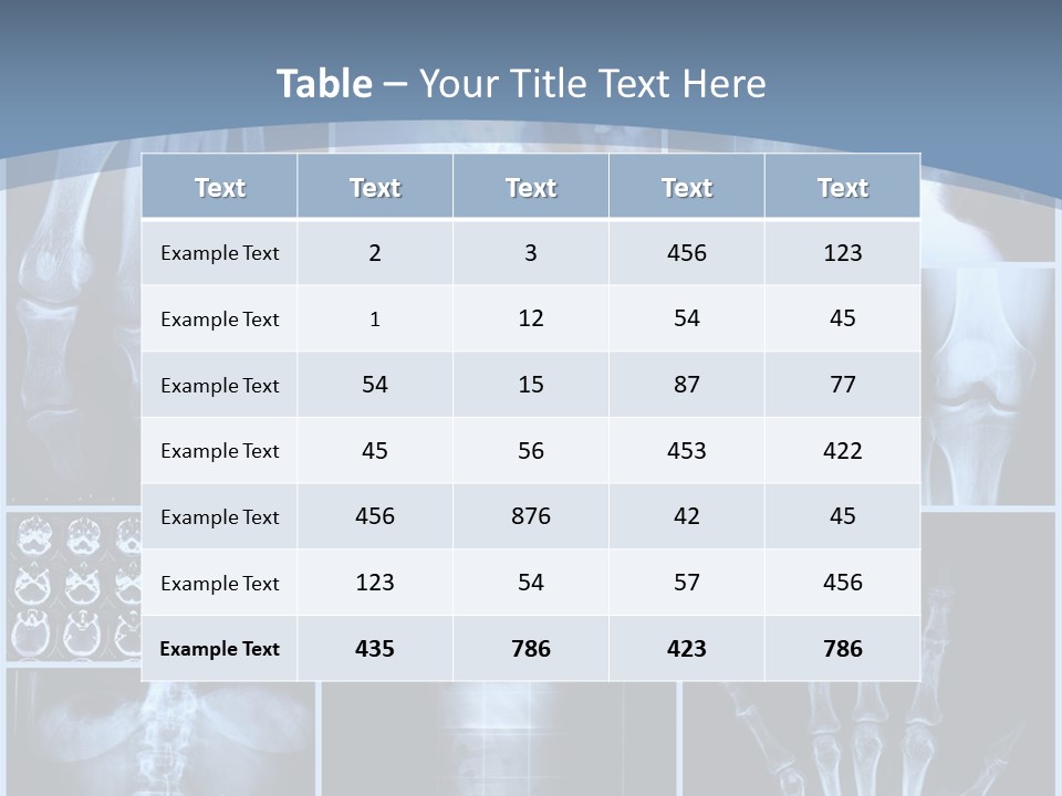Radiation Shin Bones PowerPoint Template